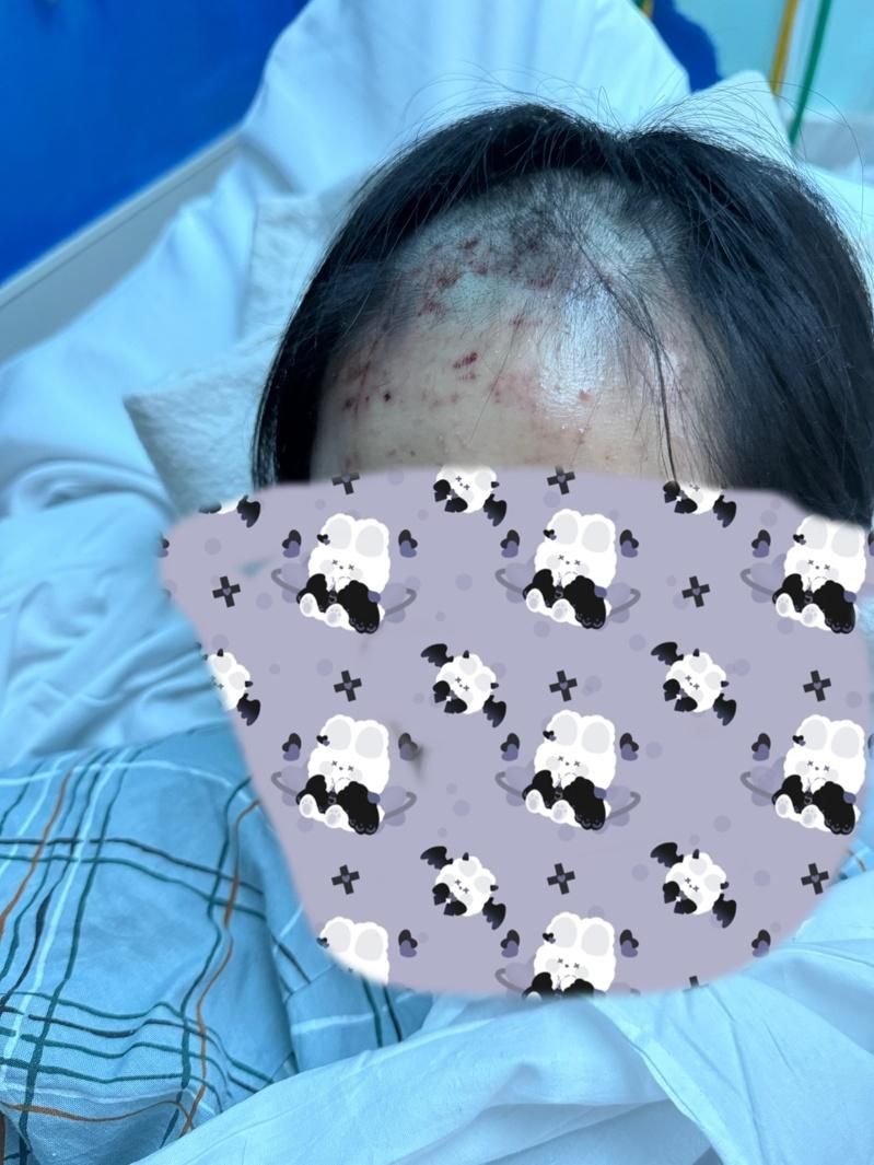 凯辛纳公园遭暴打华裔少女 足不出户母忧心