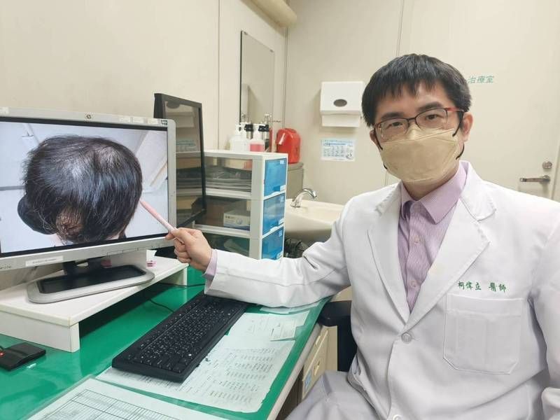 30多岁男染梅毒 发量减少长红疹 误以为是雄性秃